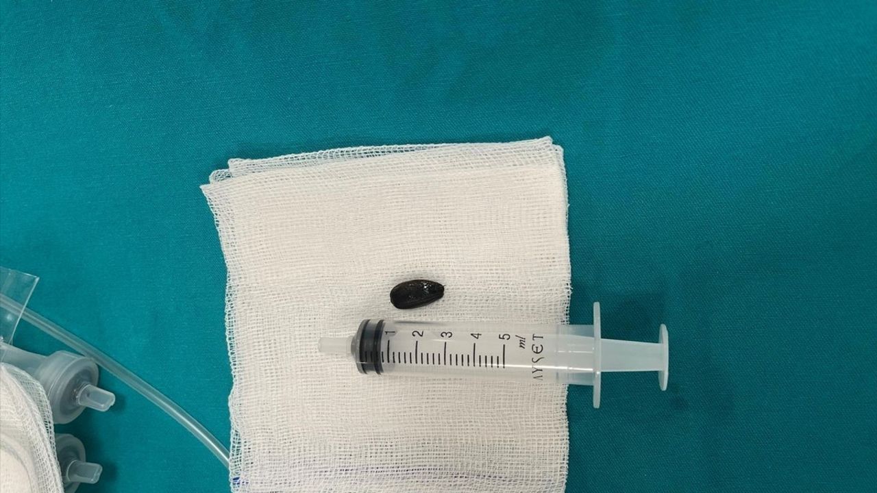 Batman'da 15 Aylık Bebek Akciğerinden Çekirdek Kabuğu Çıkarıldı