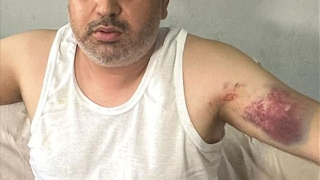 Adana'da Yeğenini Darbeden Kişi Tutuklandı