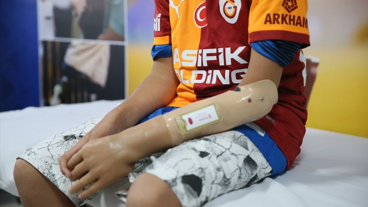Mehmet Efe'nin Hayali Gerçek Oldu: Yeni Kol Protezi ile Oyun Oynadı