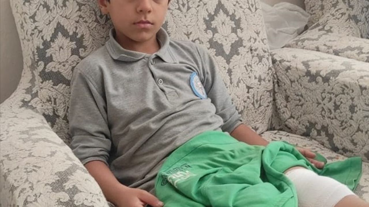 Bursa'da Sahipsiz Köpeğin Saldırısı: Bir Çocuk Yaralandı
