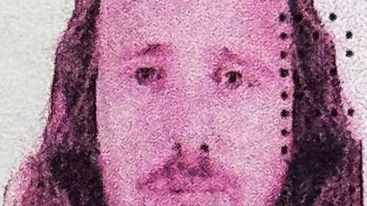 İngiliz Vatandaşı Mentor Rama Türkiye'de Saç Ekimi ve Diş Tedavisi Sonrası Hayatını Kaybetti