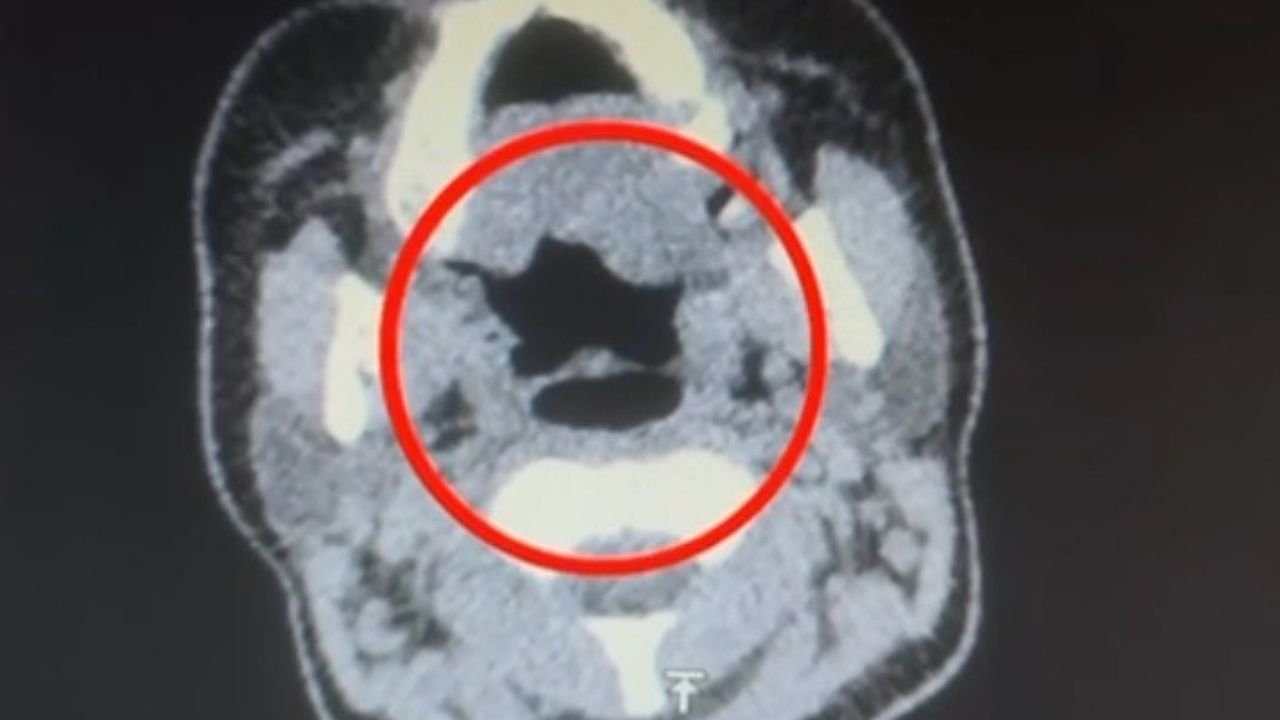 Uluslararası Uyuşturucu Ticareti: Kayseri'de Şok Operasyon