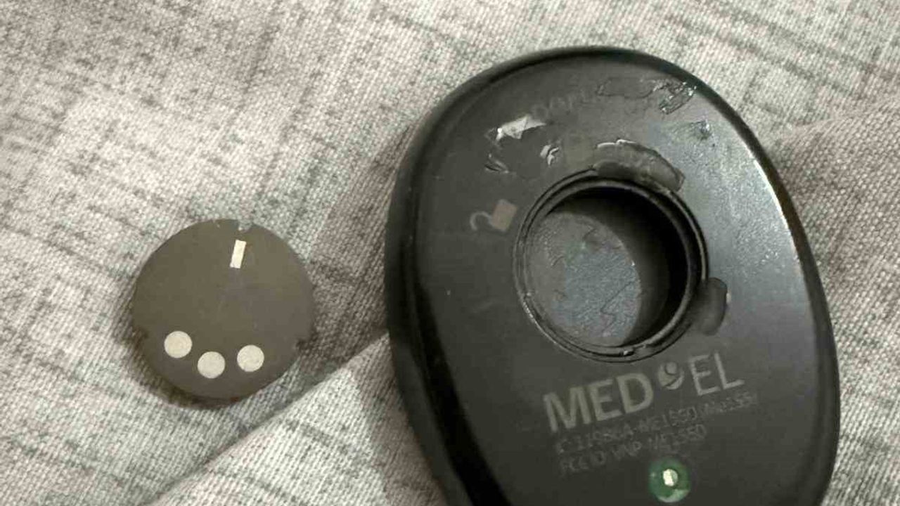 Adana'da İşitme Engelli Genç Darp Edildi