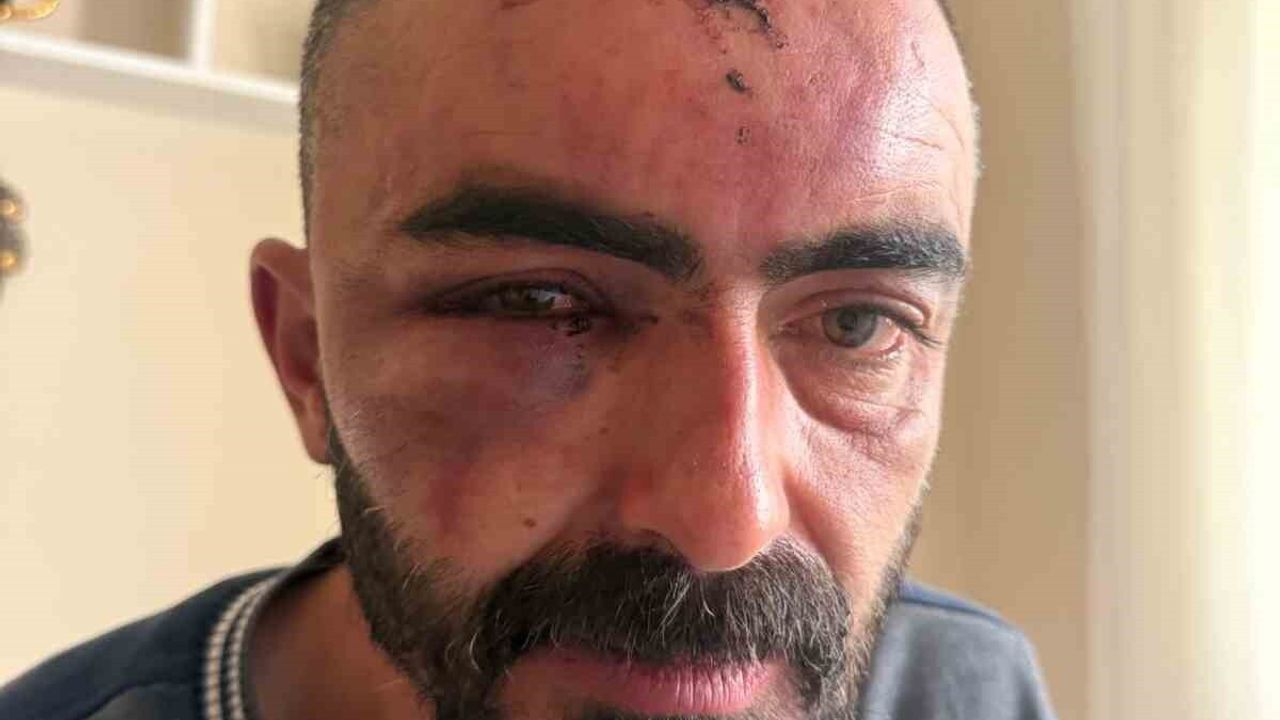 Ankara'da Kundaklama Olayı: Sinirle İşlenen İki Kardeşin Hikayesi