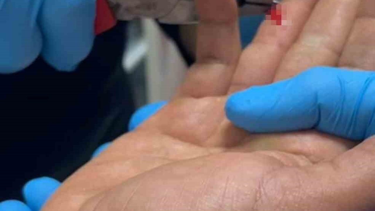 Balık Avında Kaza: Parmağına İğne Saplanan Adam Hastaneye Gitti