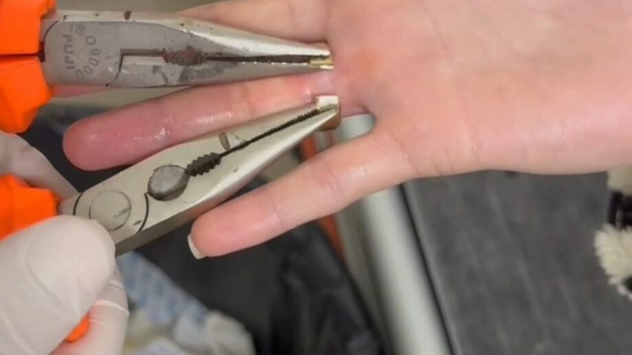 Batman'da Yüzük Sıkışması: İtfaiye Ekipleri Operasyonla Kurtardı