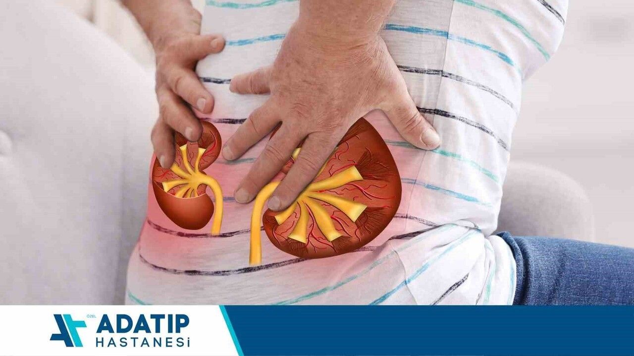 Böbrek Taşı Hastalığı ve Kişiye Özel Tedavi Yöntemleri