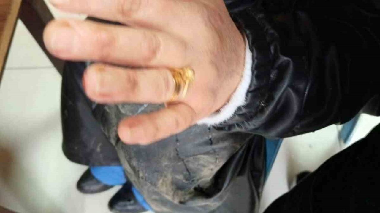 Diyarbakır'da Başka Köpek Saldırısı: İki Yaralı