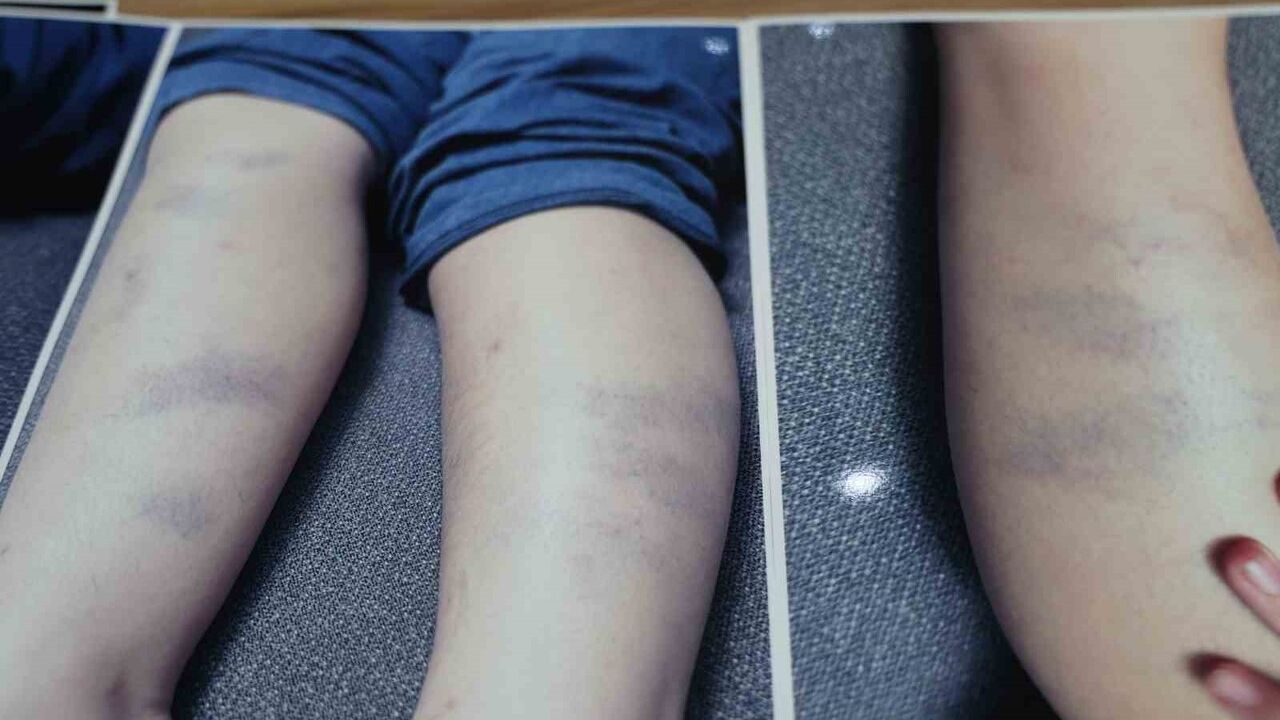 Diyarbakır'da Özel Okulda Çocuğun Darp Edildiği İddiası