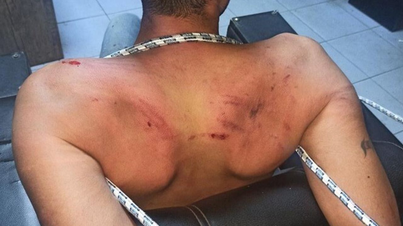 Hamam Böceği İle İşkence: Genç İçin 6 Yıl 12 Ay Ceza