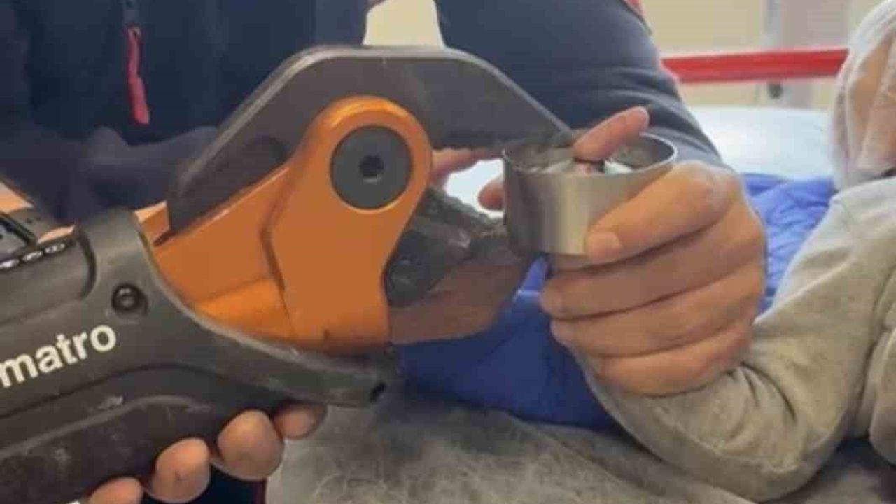 İtfaiye Ekipleri, Çelik Küllüğe Sıkışan Bebeği Kurtardı