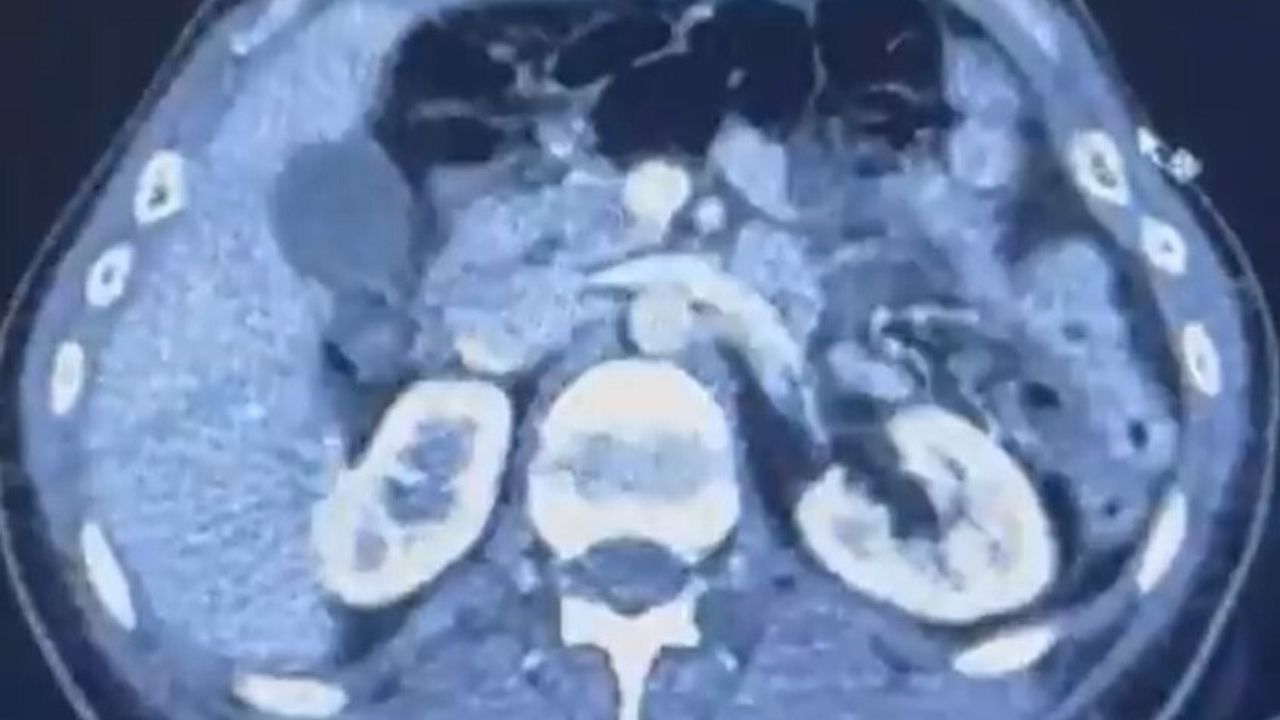 Kayseri'de uyuşturucu taşıyan şahıslar yakalandı