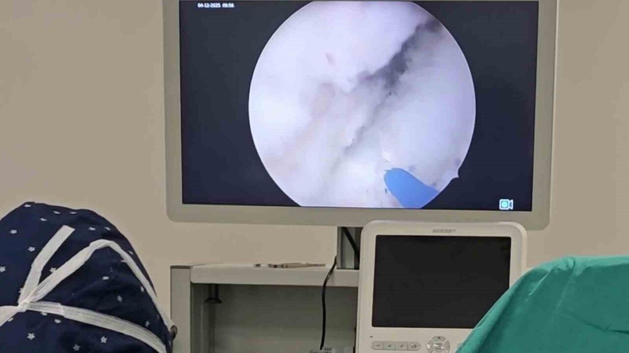 Prostat Büyümesi için Holep Yöntemi: Kesin Çözüm