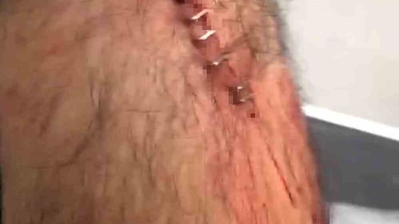 Şanlıurfa'da Öğretmene Jiletli Saldırı