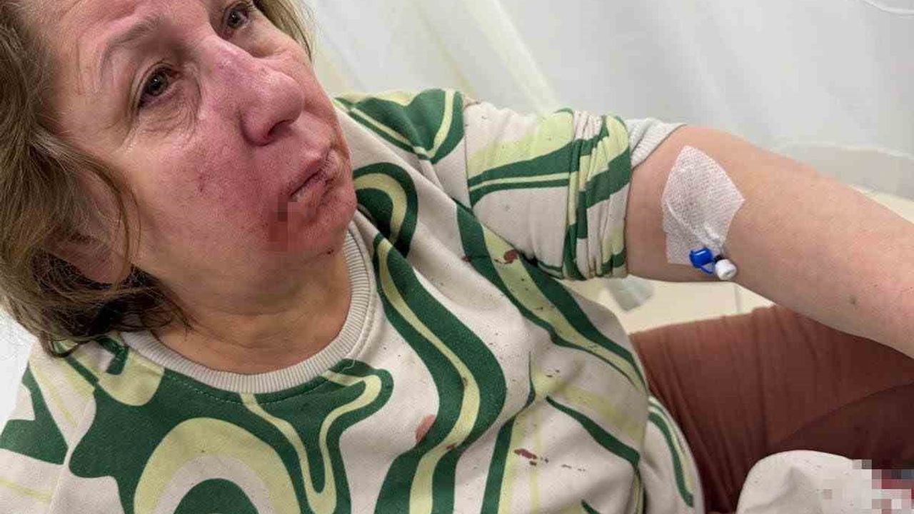 Sarayköy'de Komşusunu Darp Eden Memura Soruşturma