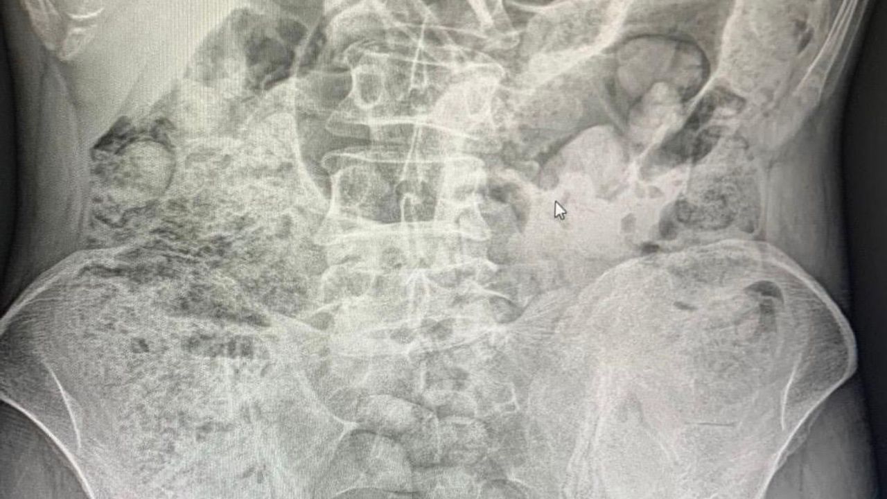 Siirt'te Uyuşturucu Taşımacılığı: 4 Kişi Tutuklandı