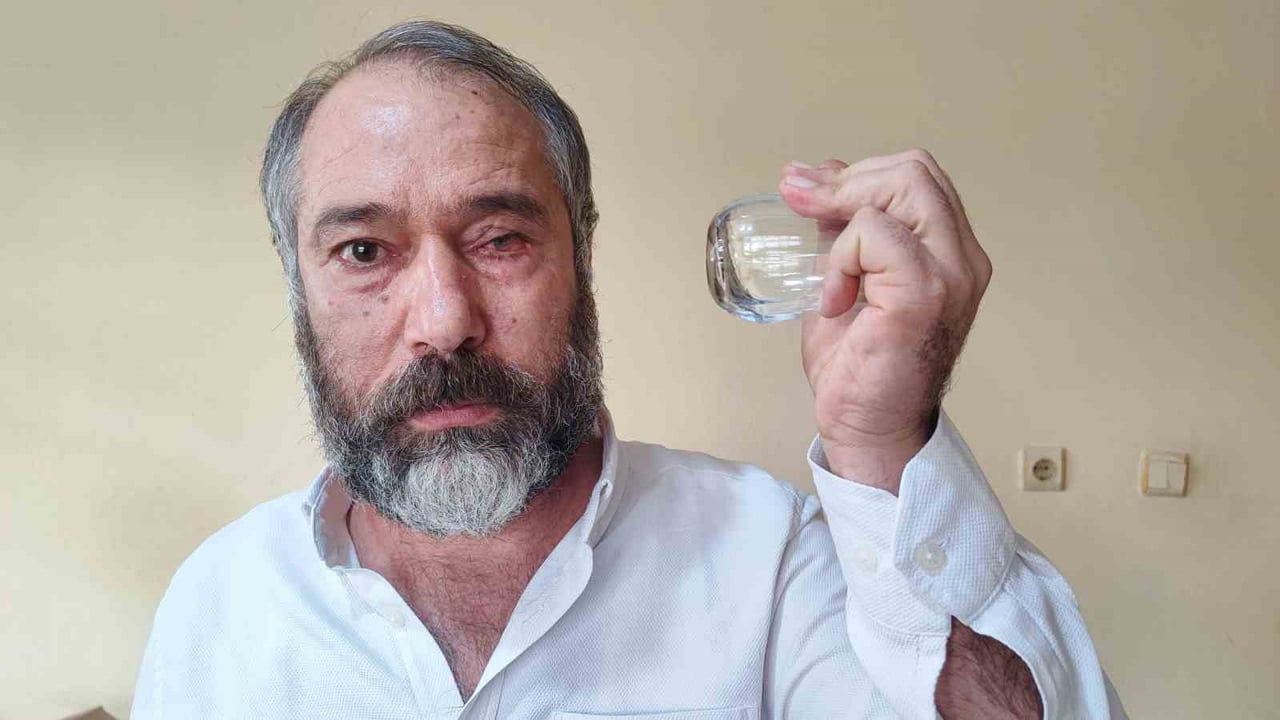 Adana'da Dolmuş Şoförüne Saldırı: Gözünden Oldu