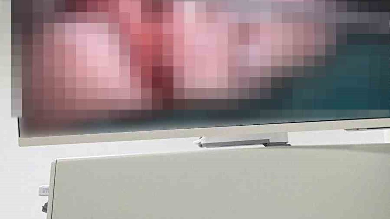 Bandırma'daki Asansör Kazasında Kopan Parmak Başarıyla Yeniden Dikildi