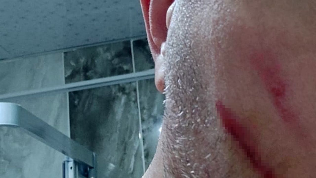 Elazığ'da Otobüs Yolcusuyla Çıkan Kavga