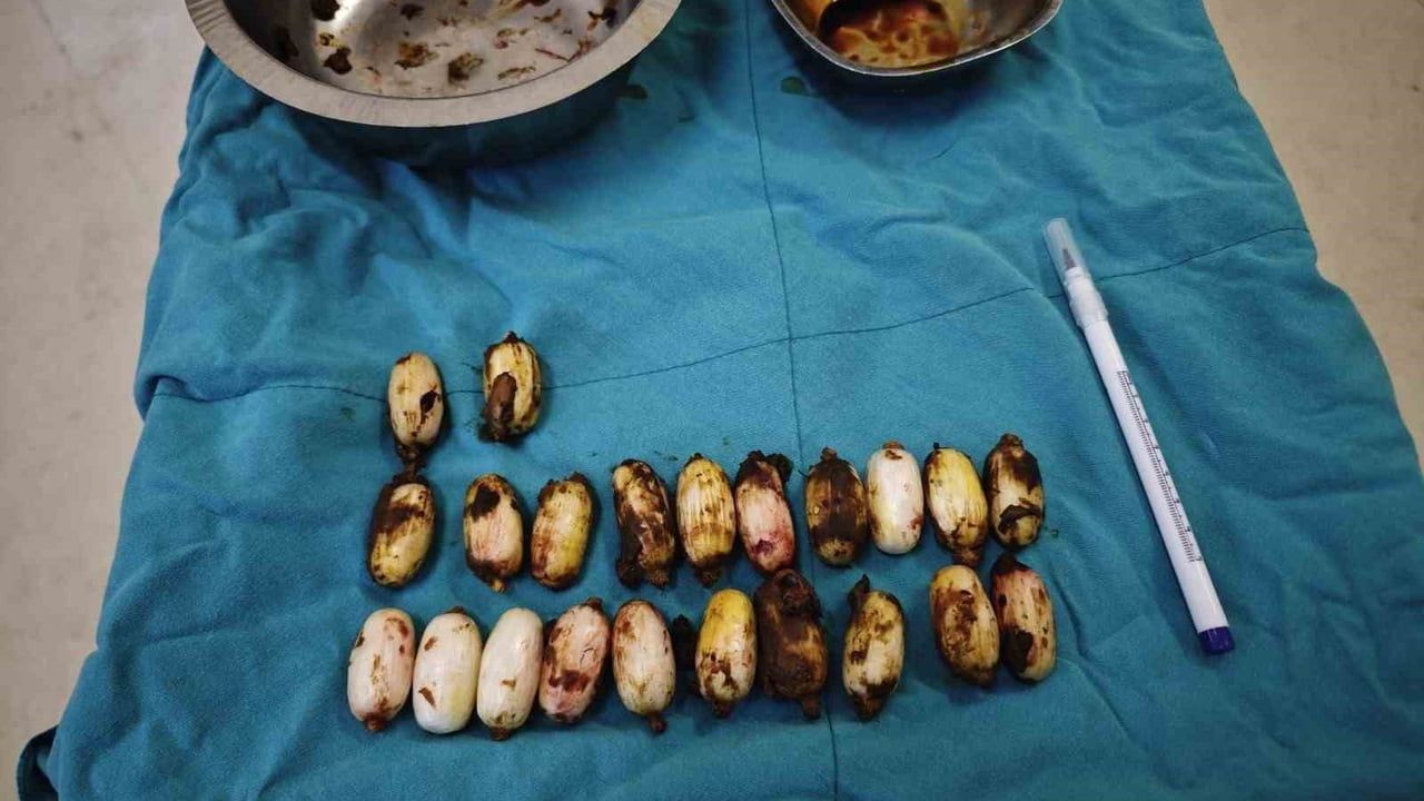 Eskişehir'de Uyuşturucu Operasyonu: 44 Kapsül Ele Geçirildi