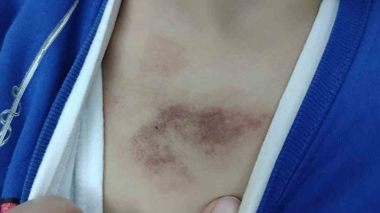 İBB Kreşinde İstismar İddiaları: Aile Suç Duyurusunda Bulundu