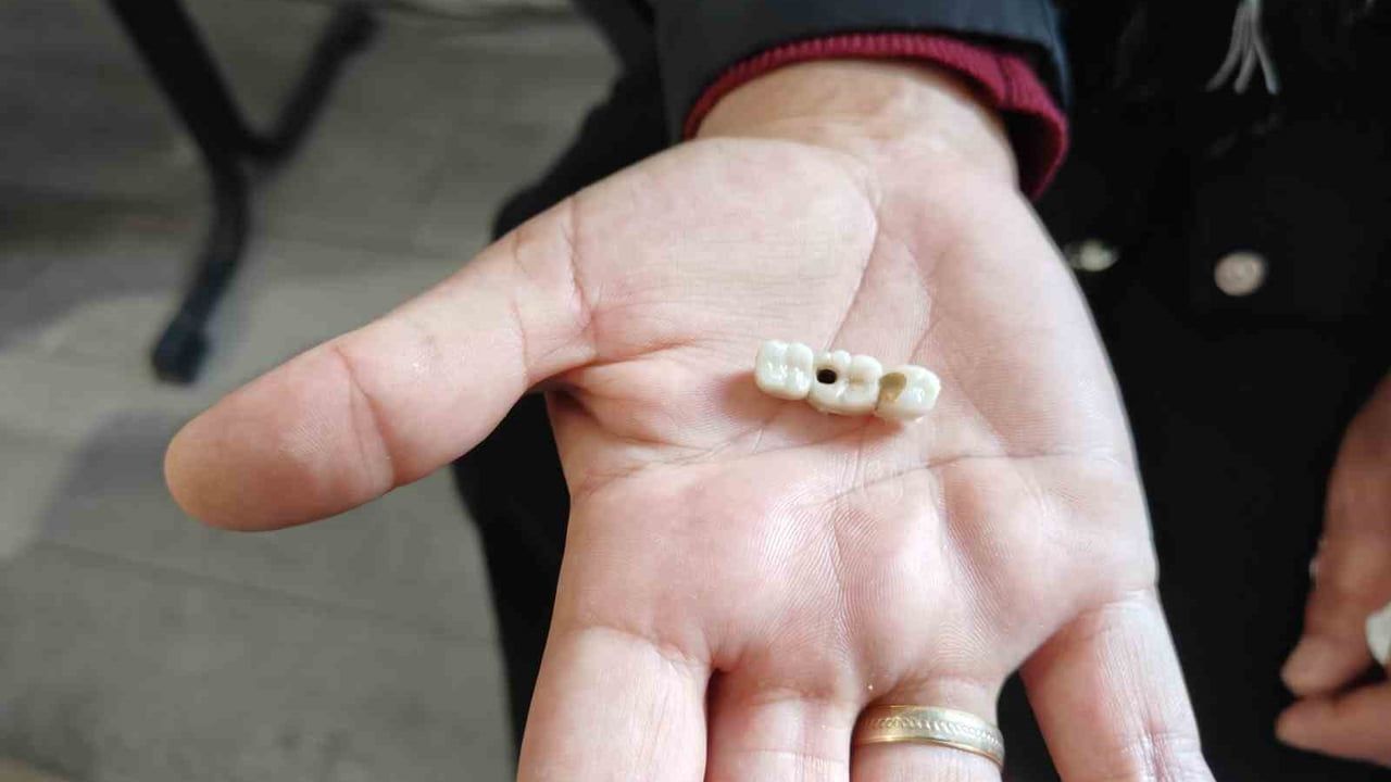 Kayseri'de İmplant Sorunu Yaşayan Kadın Yetkililerden Yardım İstedi