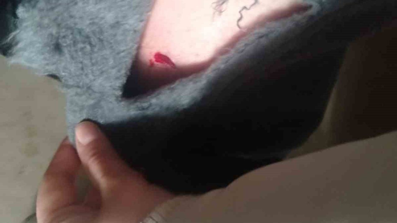 Kayseri'de Sokak Köpeği Saldırısı: Bir Çocuk Yaralandı