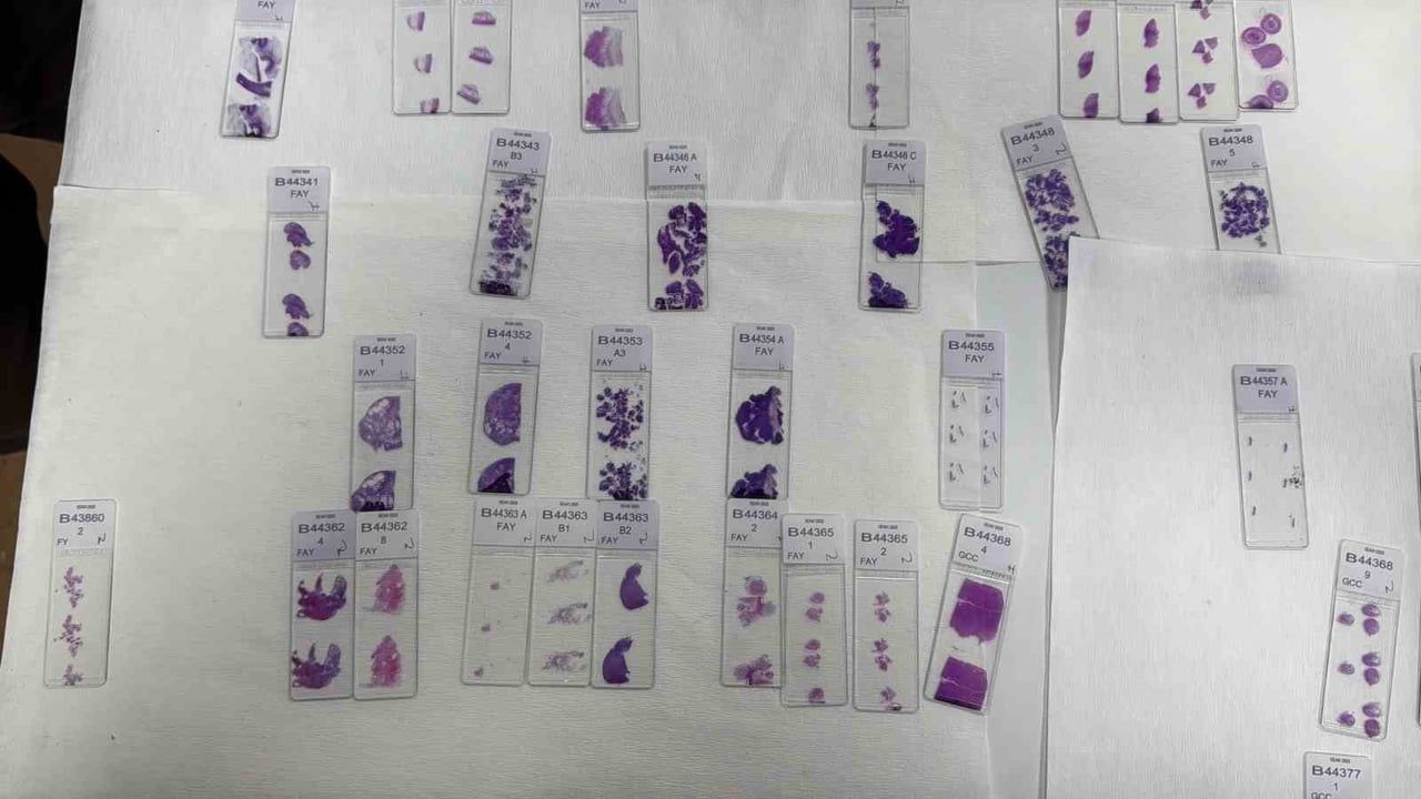 Patologlar: Tıbbın Hakim ve Savcıları