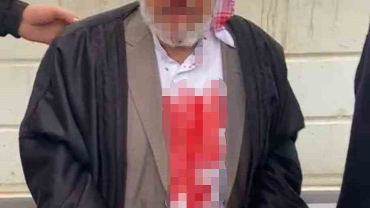 Şanlıurfa'da Yaşlı Adamı Döven 4 Kişi Tutuklandı