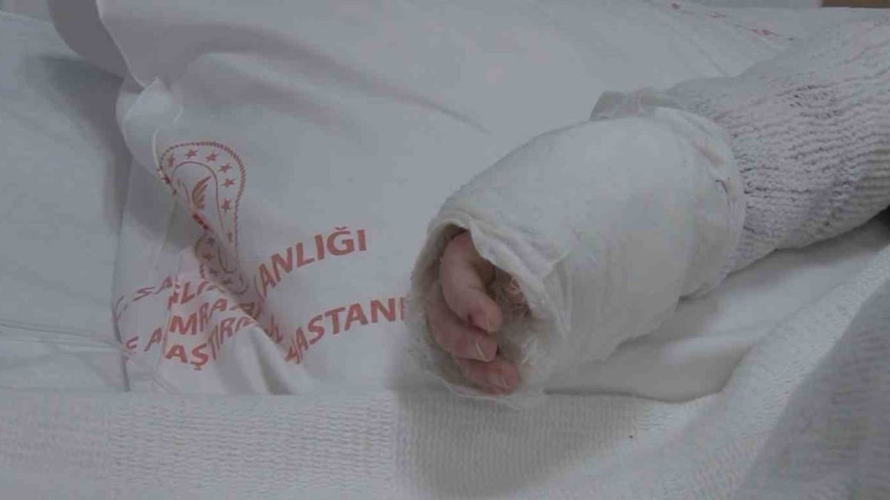 Kaynar Su Yanıkları: Önlem Almanın Önemi