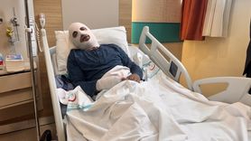 Erzurum'da Spray Boya Tüpünün Patlaması: Genç Adam Ağır Yaralandı