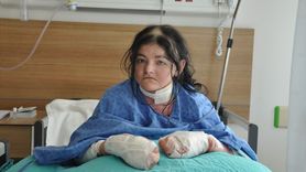 Eskişehir'de 'Kelebek Hastalığı'na Şifa