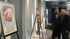 Romatizmal Hastalıkların Görselleştirilmesi: Kayseri'de Yaratıcı Bir Sergi