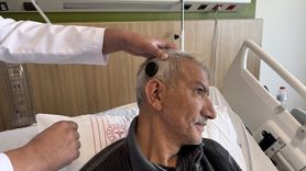 Koklear İmplant Ameliyatıyla İşitme Kaybı Aşılacak