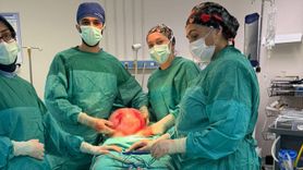 Amasya'da Kadının Karnından Karpuz Kadar Kitle Çıkarıldı