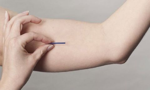 Doğum kontrolünde yeni dönem: Yüzde 99'a kadar etkili