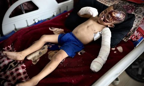 Minik Ahmed'in Zorlu Hayatı: İsrail Saldırısında Hem Yetim Hem Yaralı