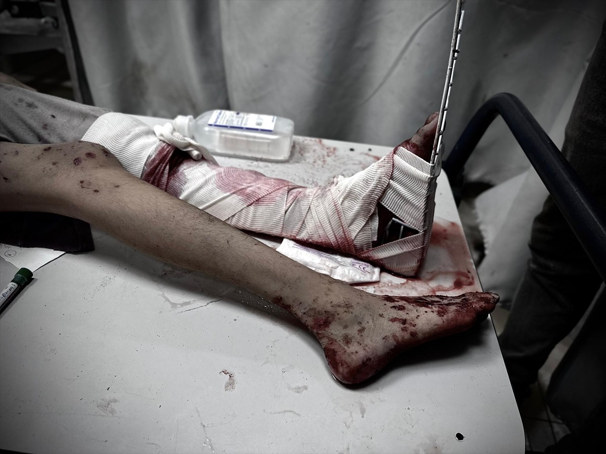 İsrail'in abluka altındaki Gazze Şeridi'ne yönelik saldırıları 290 gündür aralıksız devam ediyor....