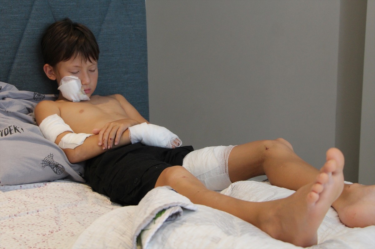 Antalya'nın Alanya ilçesinde sahipli köpeğin saldırısına uğrayan Kazakistan uyruklu 11 yaşındaki...