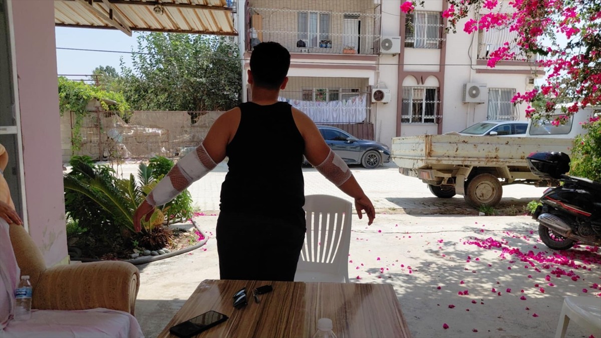 Hatay'ın Samandağ ilçesinde, sahipsiz köpeğin saldırısına uğrayan 10 yaşındaki çocuk...