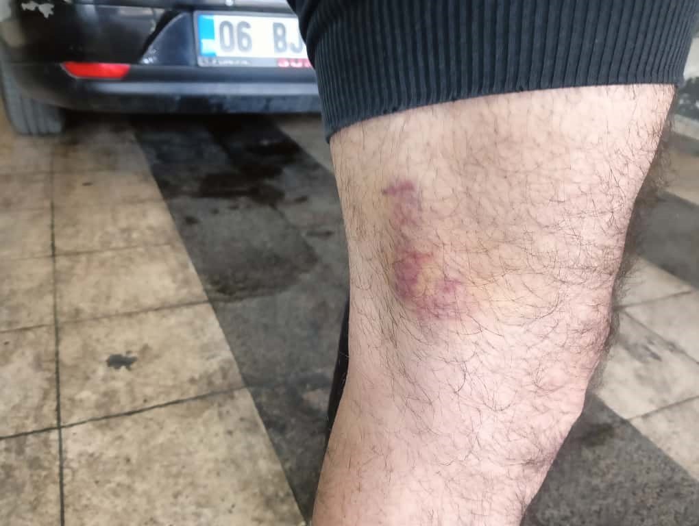 ANKARA’DA, BİR ÇİFTE HAKARET ETTİĞİ İÇİN UYARDIĞI ŞAHSIN VE ONUN BERABERİNDEKİ KİŞİLER TARAFINDAN...