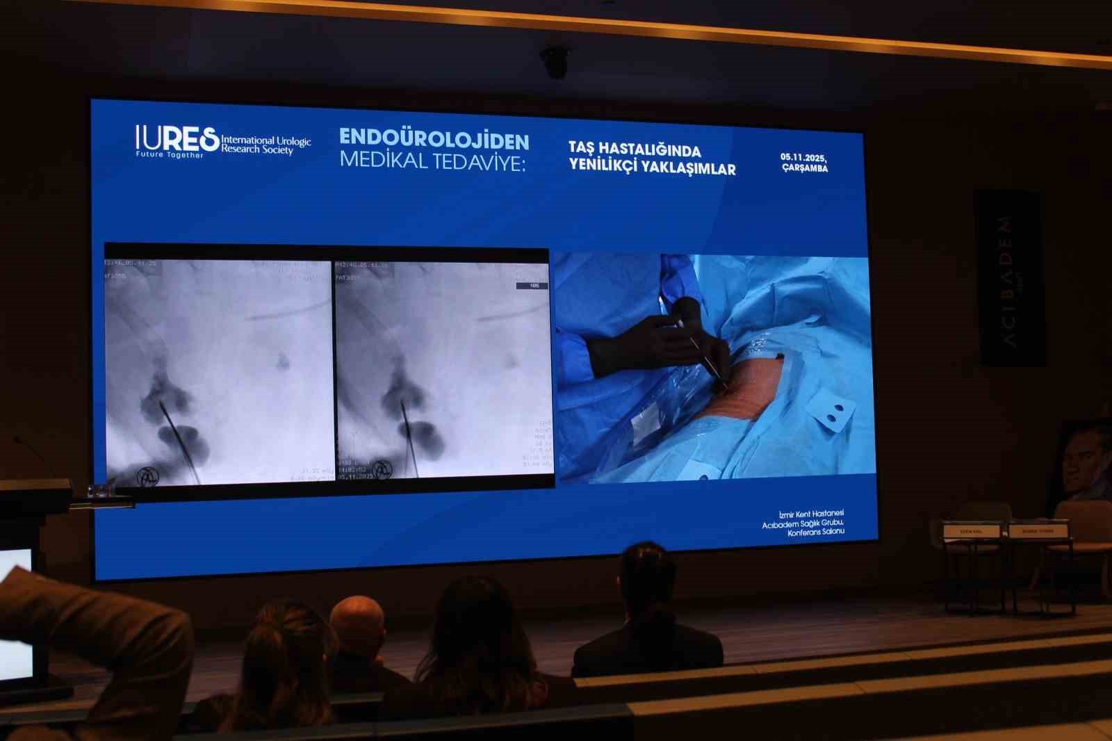 ENDOÜROLOJİ ALANINDA YAŞANAN TEKNOLOJİK GELİŞMELER HASTA KONFORUNU, CERRAHİ GÜVENLİĞİ VE TEDAVİ...