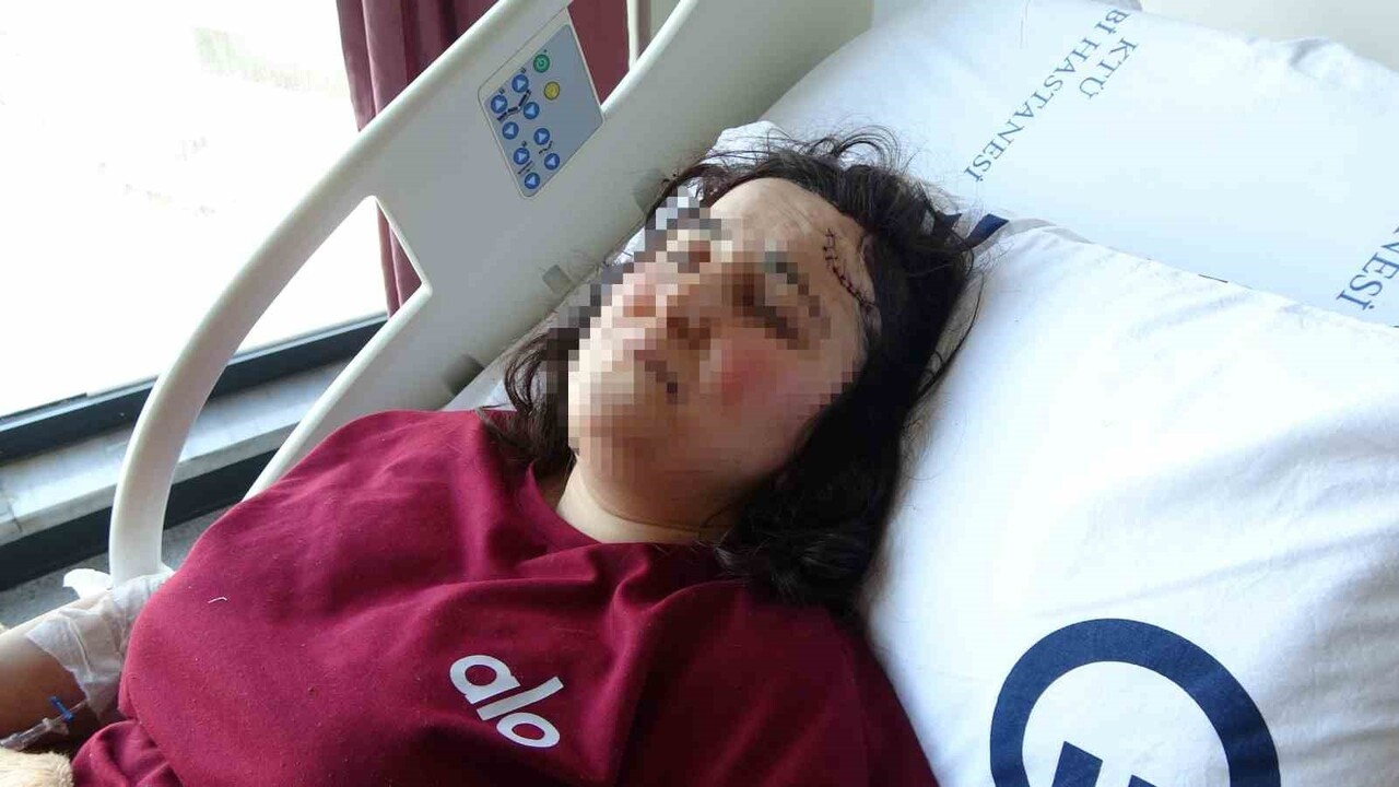 SALDIRI SONUCU DİL KÖKÜNÜN KEMİĞİNİN KIRILMASI VE DİLİNDE KESİKLER OLUŞMASI NEDENİYLE KONUŞAMAZ...