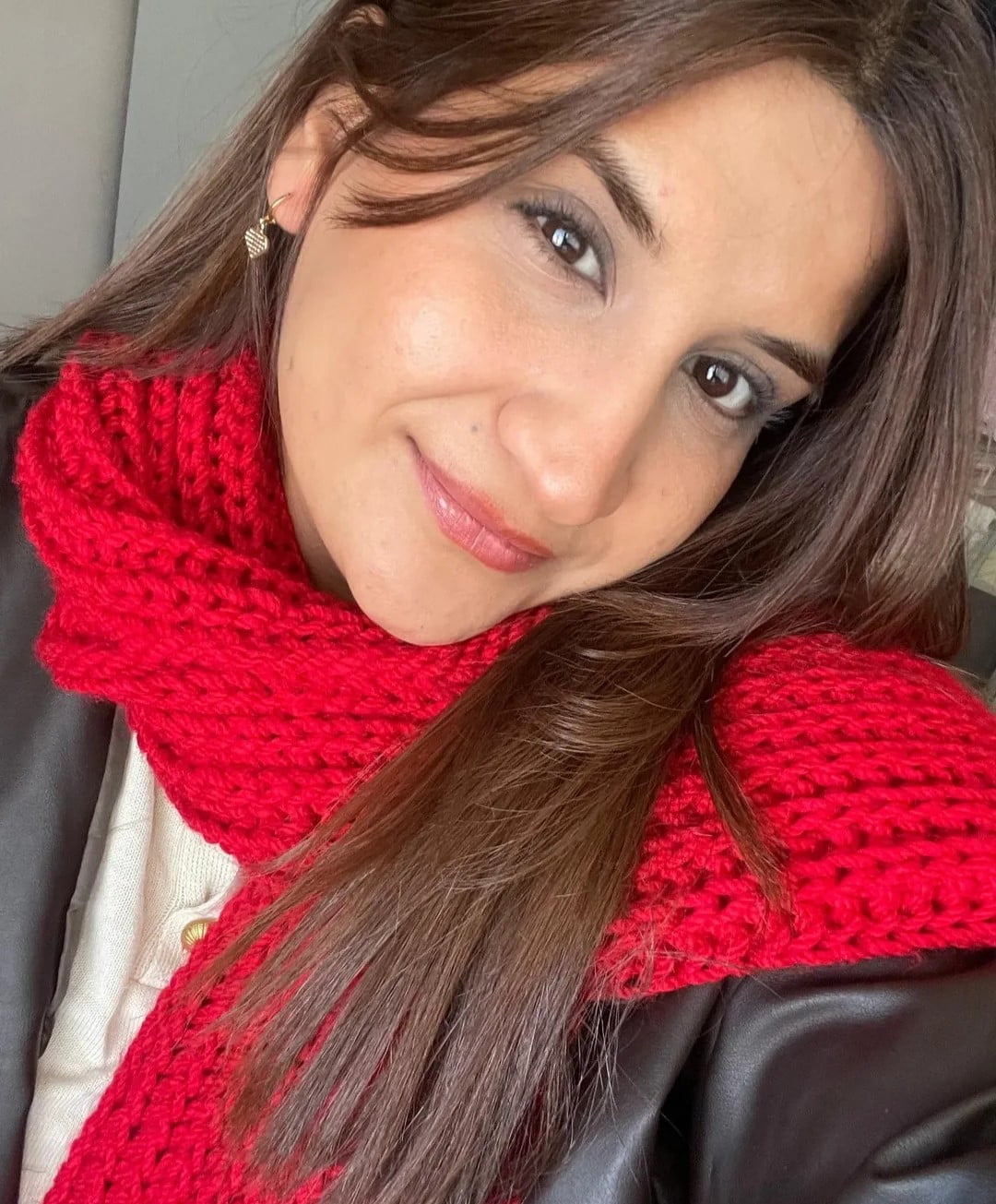 AĞRI'DA YUMURTAYA ALERJİSİ BULUNAN ÜNİVERSİTE ÖĞRENCİSİ REMZİYE HORUZ (25), DOĞUM GÜNÜ İÇİN...