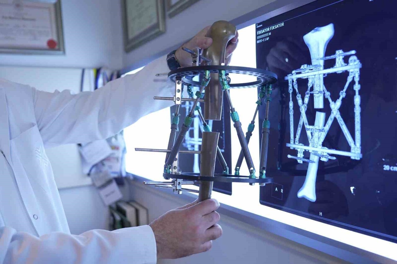 DR. ADNAN KARA, KEMİĞİN KENDİ İYİLEŞME POTANSİYELİNİ KULLANAN YENİ NESİL TEDAVİLERİN ARTIK ÇOK...