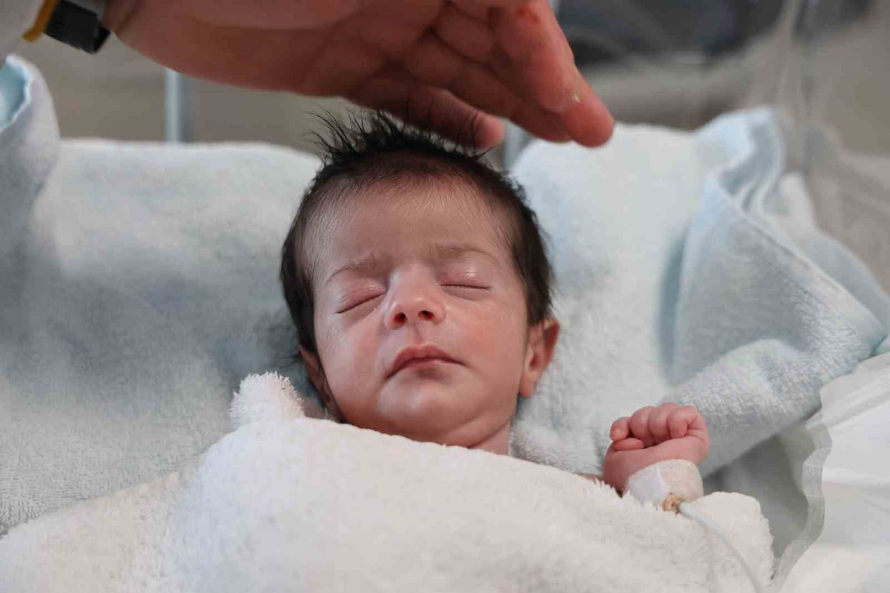 DOĞUŞTAN YEMEK BORUSU OLMAYAN BEBEK DOĞUMUNUN 4'ÜNCÜ GÜNÜNDE YAPILAN BAŞARILI AMELİYAT İLE...