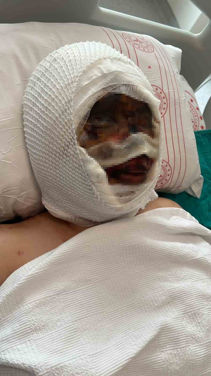 ESKİ EŞİ TARAFINDAN VAHŞETE UĞRAYAN KADIN O ANLARI ANLATTI, ACILI BABA SERT TEPKİ GÖSTERDİ