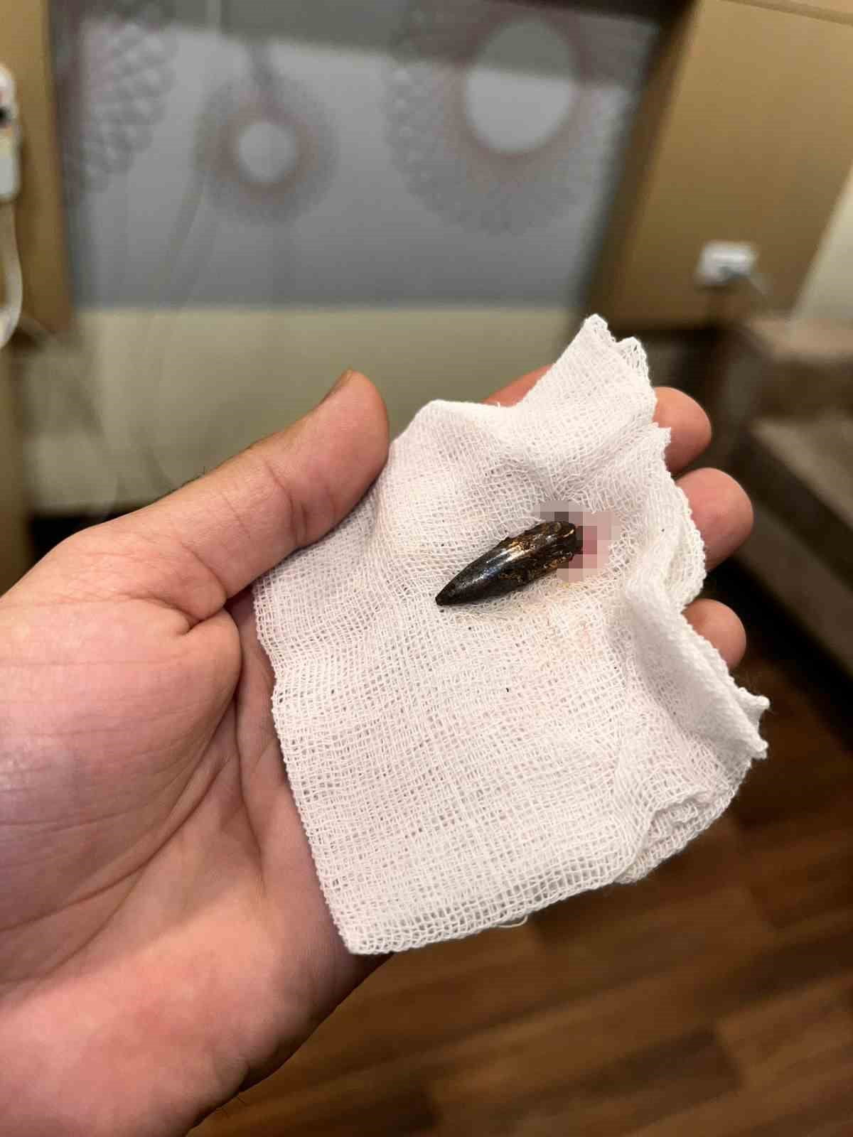 İSRAİL ORDUSUNUN GAZZE ŞERİDİ'NE YÖNELİK SALDIRILARINDA BAŞINDAN VURULAN KÜÇÜK AWAD, 1,5 YIL...