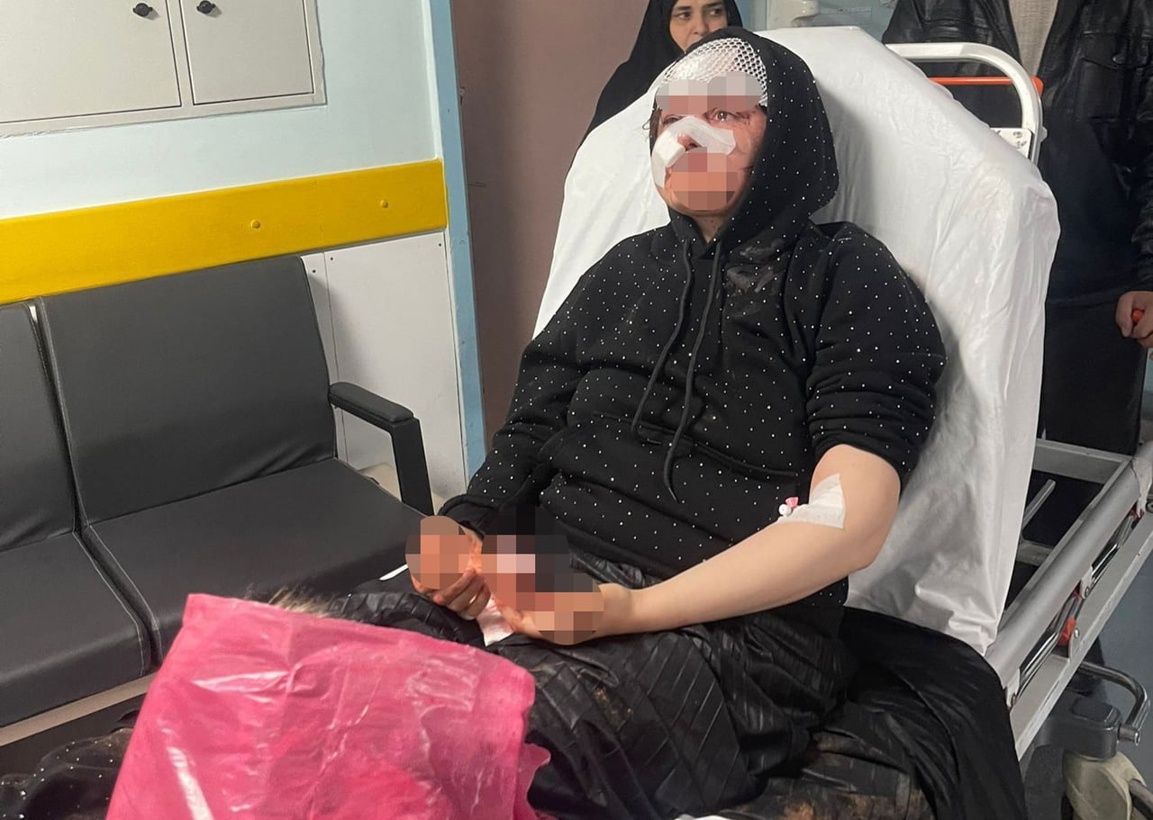 NAZLI YAVUZ (26), BOŞANMAK İSTEDİĞİ KOCASI TARAFINDAN SOKAK ORTASINDA ÖLDÜRESİYE DARP...